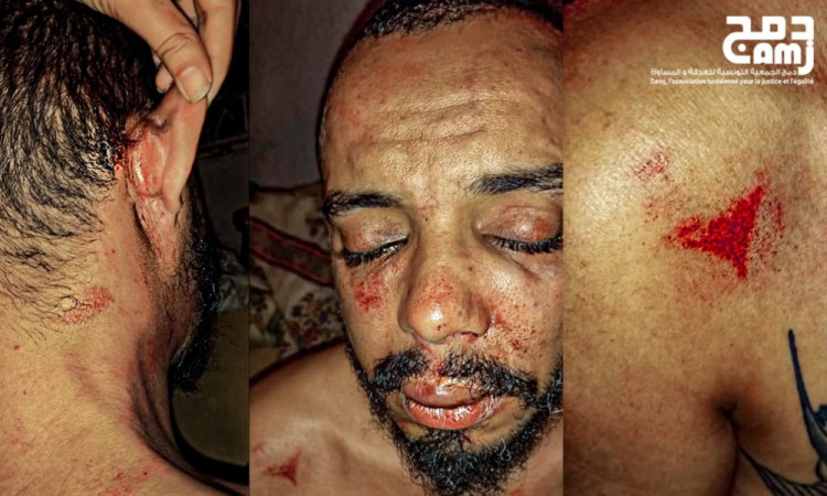 Police attempt to ‘silence’ Tunisian activist