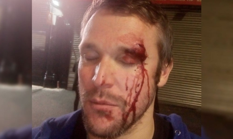 Another homophobic attack in Birmingham