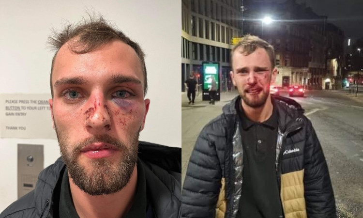 Gay man left needing surgery after being brutally beaten