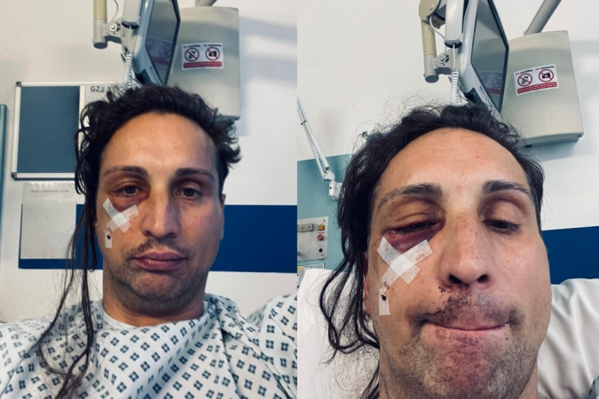 Gay man was attacked in homophobic hate crime