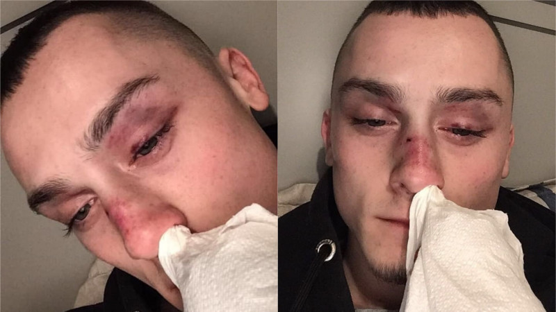 Homophobic gang attack gay couple with hammer